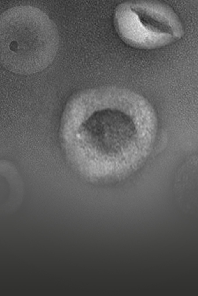 Exosome